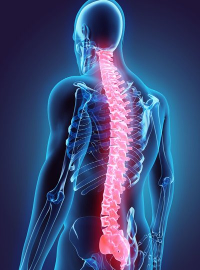 spinal injury